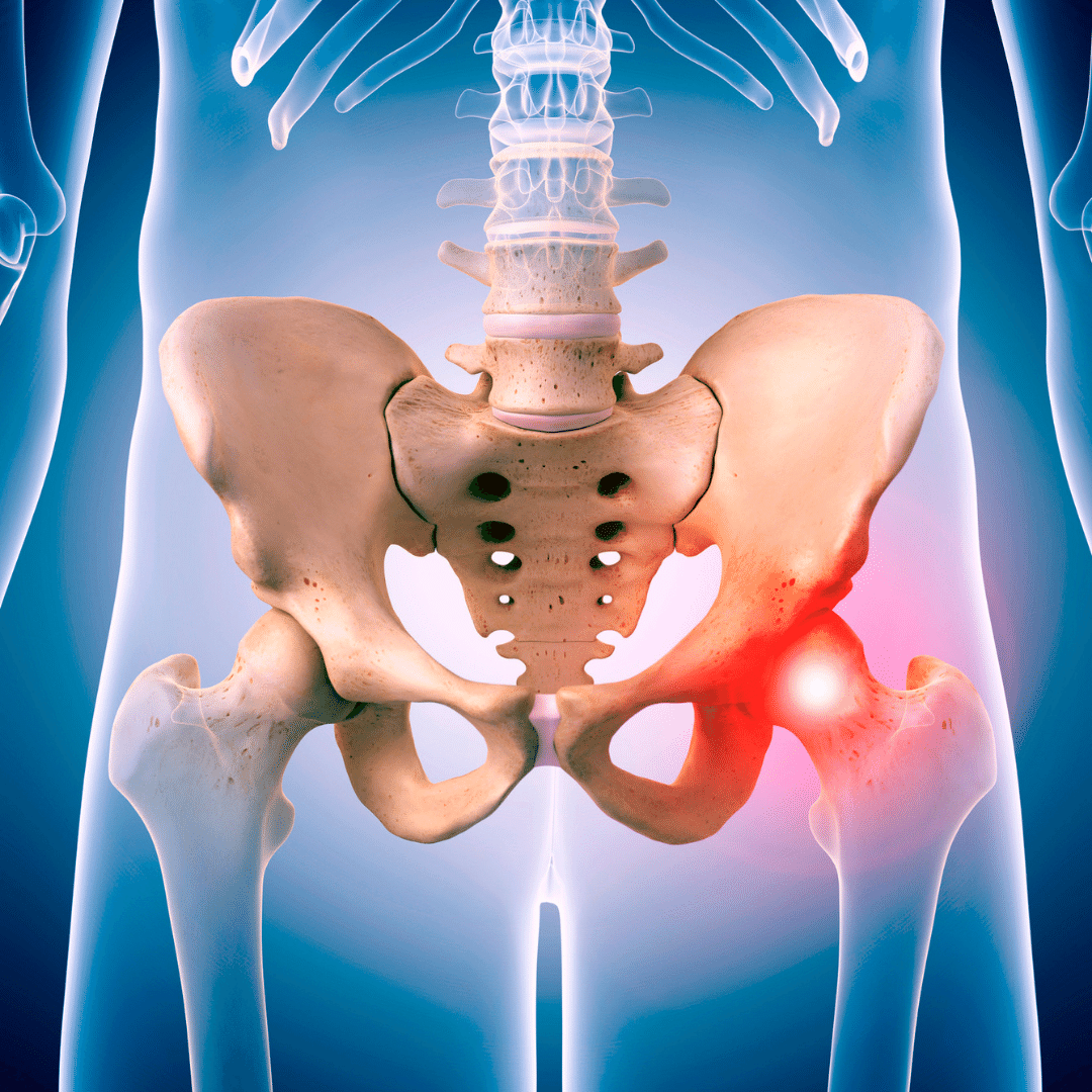 Referred Pain and Other Sources of Hip Pain