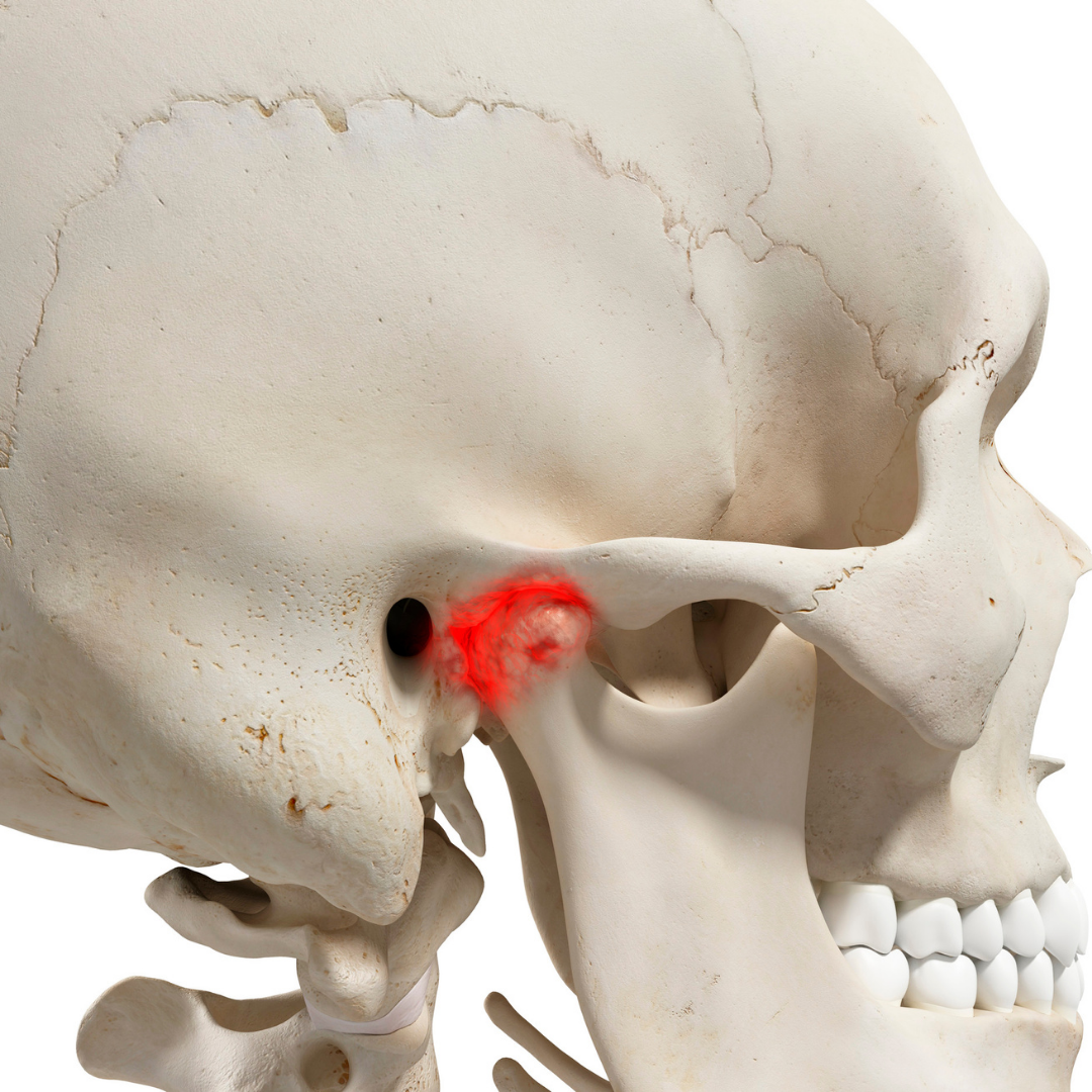 Causes Of TMJ