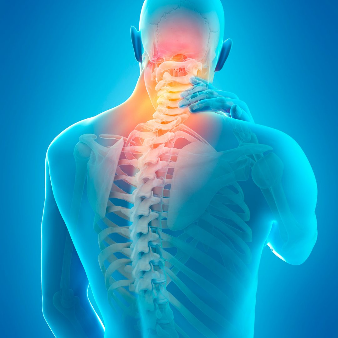 What Is Neck Pain?